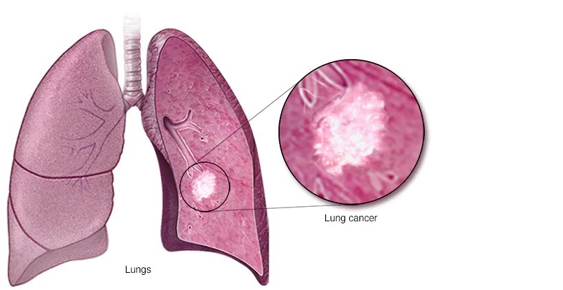 Cardiology